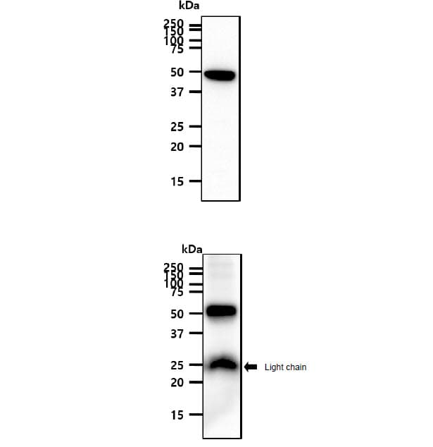 PNPLA2 / ATGL Antibody (clone AT18E6)
