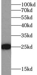 Polyclonal Rabbit anti-Human GSTP1 / GST Pi Antibody (IHC, IF, WB)
