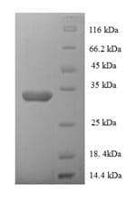 Human NAA38 / LSMD1 Protein (Recombinant 6His-SUMO, N-terminus)