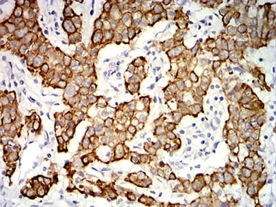 KRT19 / CK19 / Cytokeratin 19 Antibody (clone 8H1A8)