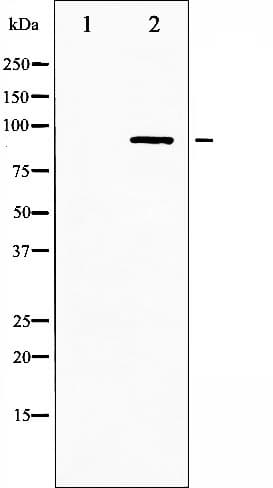 Polyclonal Rabbit anti-Human CHUK / IKKA / IKK Alpha Antibody (phospho-Ser180,phospho-Ser181, IHC, IF, WB)