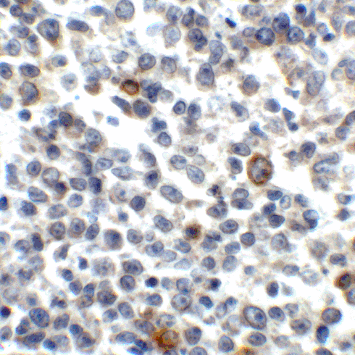 TNFSF14 / LIGHT Antibody (clone 7B9F12)