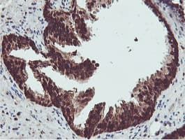 PSMB7 Antibody (clone OTI1E1)