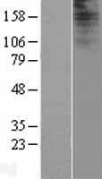 IQCF2 Protein (Over-Expression Lysate Myc-DDK (Flag))