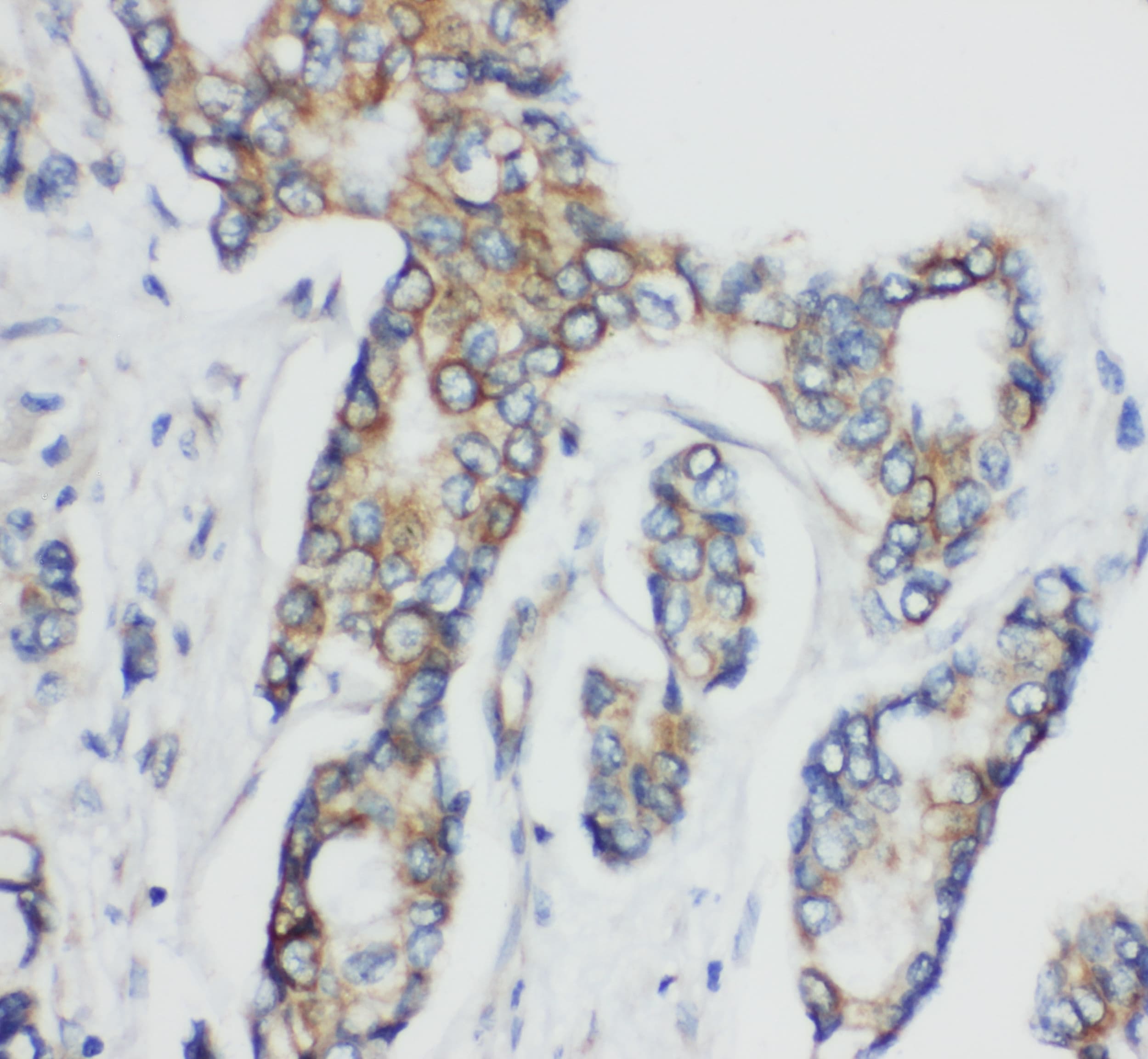 CD1D Antibody (aa76-92)