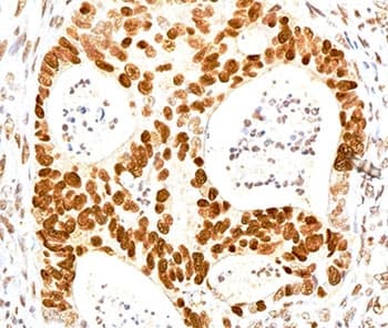 CDKN1B / p27 Kip1 Antibody (clone SX53G8, Ready-to-Use)