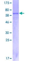 Human IL12RB1 / CD212 Protein (Recombinant GST)