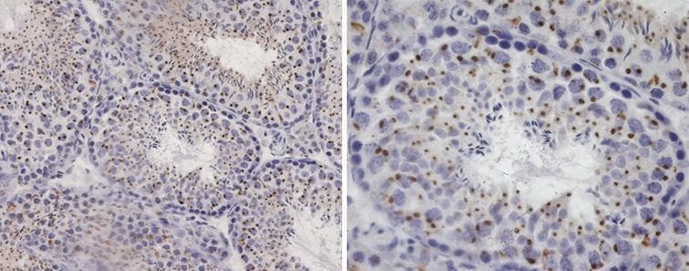 GPR45 Antibody