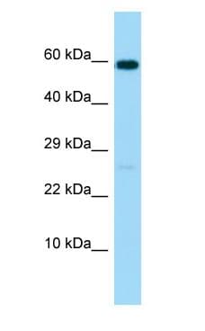 Polyclonal Rabbit anti-Human MMP17 Antibody (aa512-561, WB)