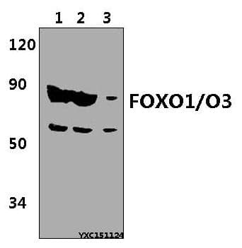 FOXO1 / FKHR Antibody