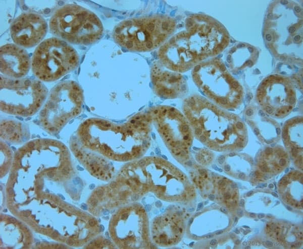 Polyclonal Rabbit anti-Human ITPR1 / IP3 Receptor Type 1 Antibody (aa700-750, IHC)