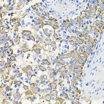Polyclonal Rabbit anti-Human ACVR2 / ACVR2A Antibody (IHC, WB)