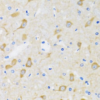 Polyclonal Rabbit anti-Human HSPH1 / HSP105 Antibody (IHC, WB)