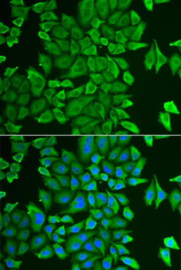 APH / APEH Antibody