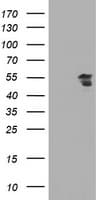 ESRRG / ERR Gamma Antibody (clone OTI1C2)