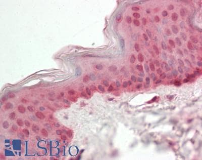 CIRP / CIRBP Antibody (N-Terminus)