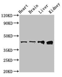 Polyclonal Rabbit anti-Human RUNX3 Antibody (IHC, IF, WB)