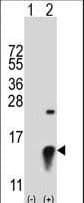 SUMO2 Antibody (aa63-93)