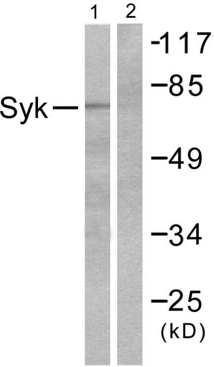 Polyclonal Rabbit anti-Human SYK Antibody (WB)