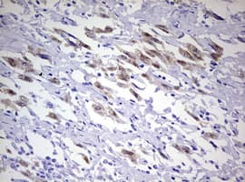 PR / Progesterone Receptor Antibody (aa1-298, clone OTI2F8)