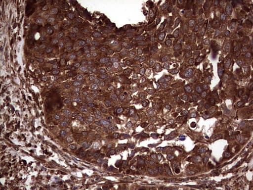 PKM2 Antibody (clone OTI12D5, Carrier-free)