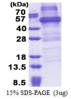 Human NOB1 / NOB1P Protein (Recombinant His)