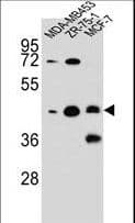 IHC-plus™ KBTBD13 Antibody (aa409-438)