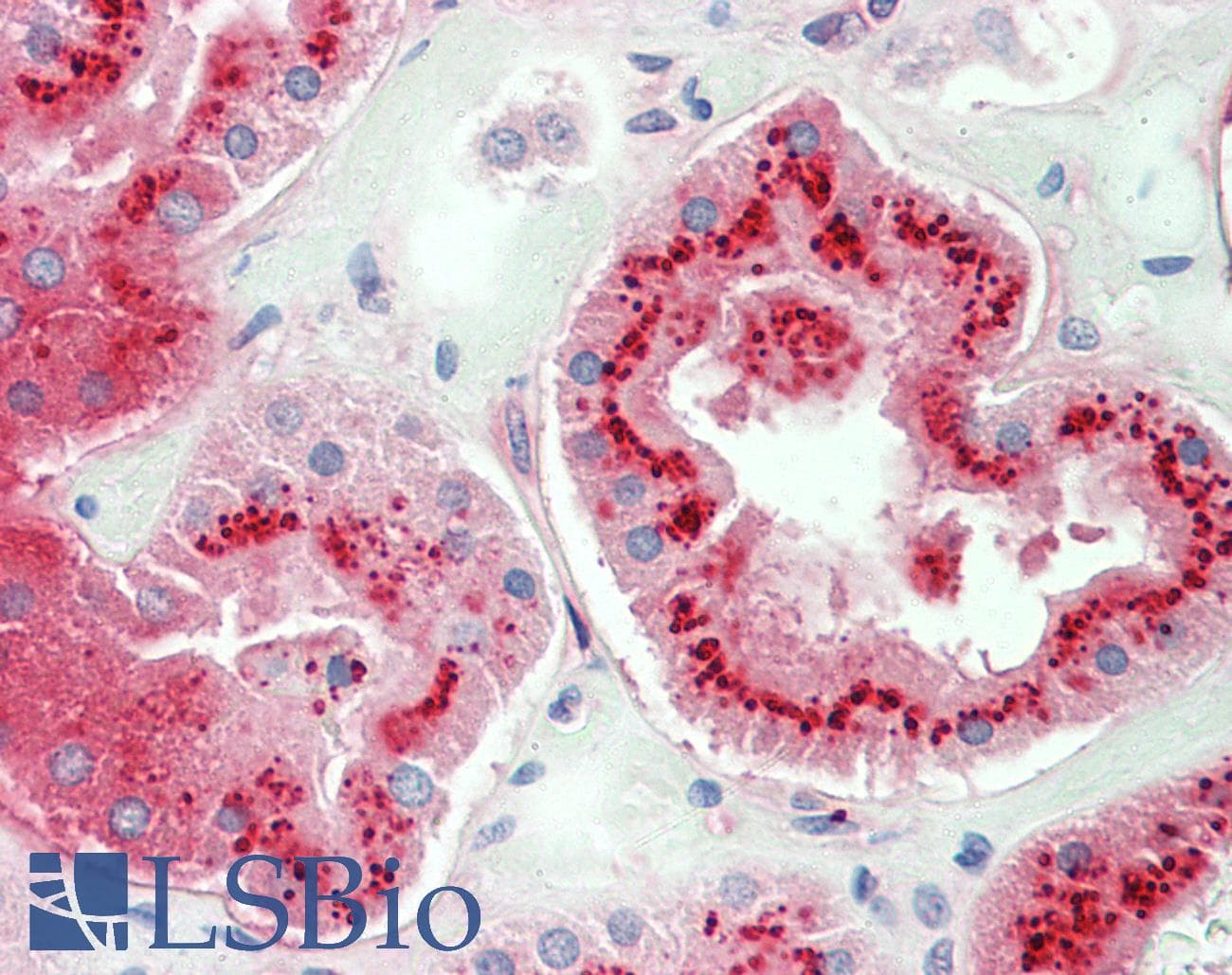 IHC-plus™ Alpha-1-Antichymotrypsin Antibody (aa222-236)