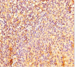 FIG1 / IL4I1 Antibody