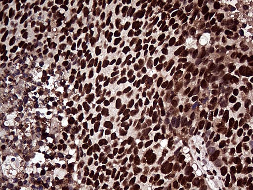 ZRANB2 / ZNF265 Antibody (aa95-320, clone OTI2E3, Carrier-free)
