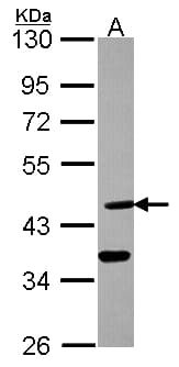 DHH / Desert Hedgehog Antibody (aa135-396)