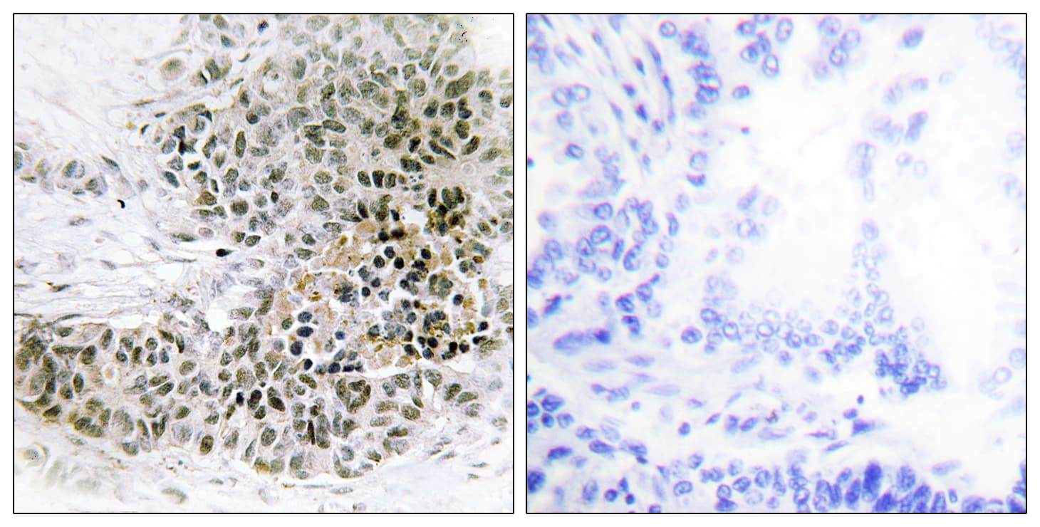 TRPS1 Antibody (aa121-170)