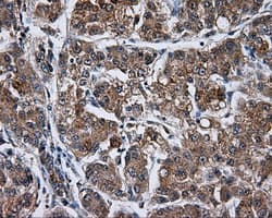 TLDC1 / KIAA1609 Antibody (clone OTI12G10)