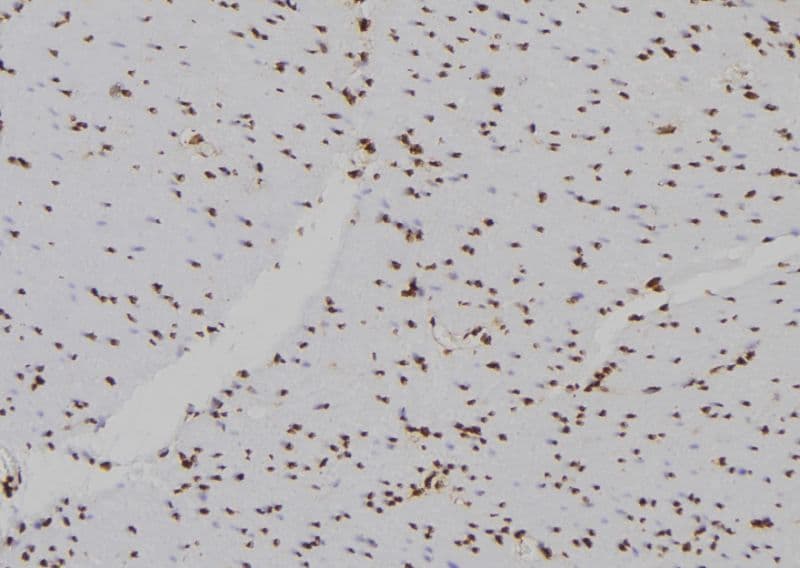 HIST2H2BE Antibody