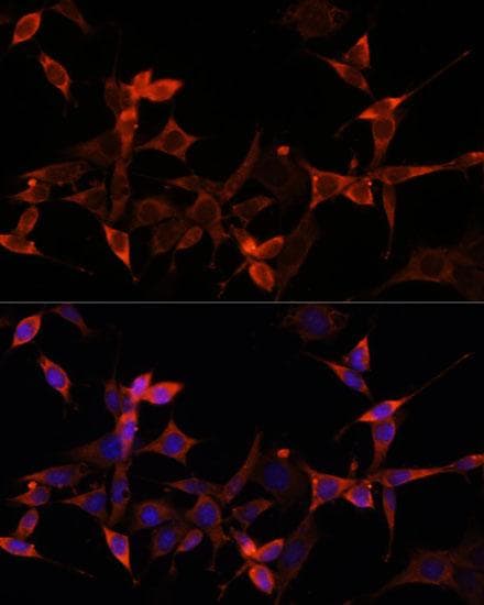 AKT1S1 / PRAS40 Antibody