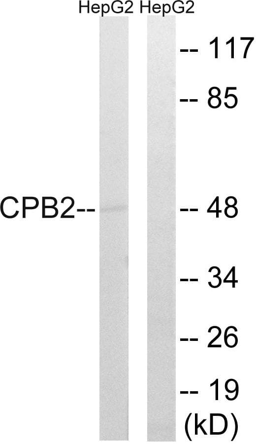 Polyclonal Rabbit anti-Human CPB2 / TAFI Antibody (WB)