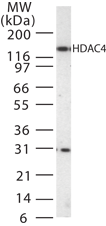 IHC-plus™ Polyclonal Rabbit anti-Human HDAC4 Antibody (aa194-209, IHC, WB)