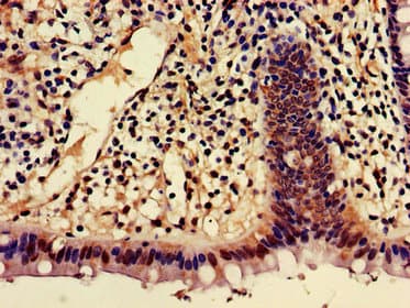 SHREW-1 / AJAP1 Antibody