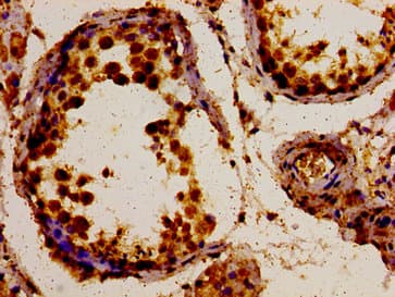 POLDIP3 / p46 Antibody