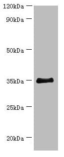 BCAT2 Antibody (aa20-200)