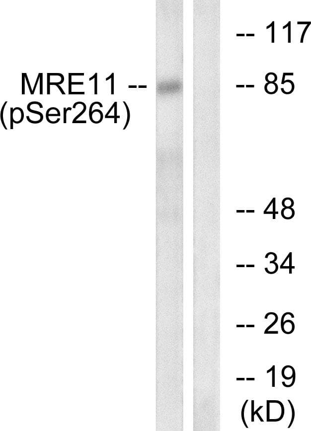 MRE11A / MRE11 Antibody (phospho-Ser264)