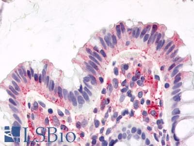 PathPlus™ BOB / GPR15 Antibody (Cytoplasmic Domain)