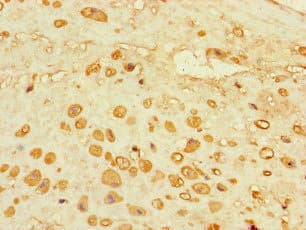 ADORA2A/Adenosine A2A Receptor Antibody