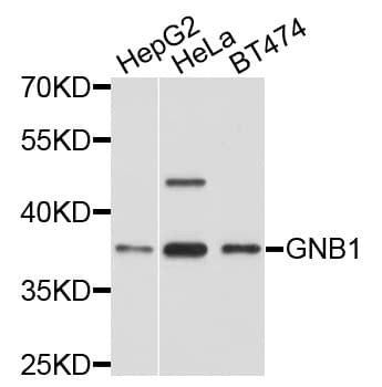 GNB1 Antibody