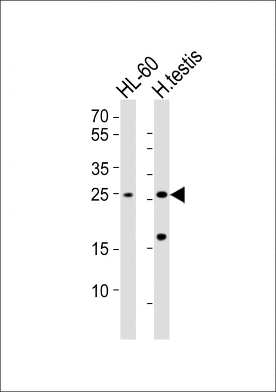 Polyclonal Rabbit anti-Human RHOXF1 Antibody (aa86-120, WB)