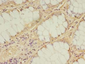 Polyclonal Rabbit anti-Human IDI2 Antibody (IHC)