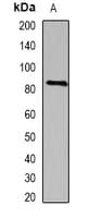 Polyclonal Rabbit anti-Human SEMA3B / SemA Antibody (WB)