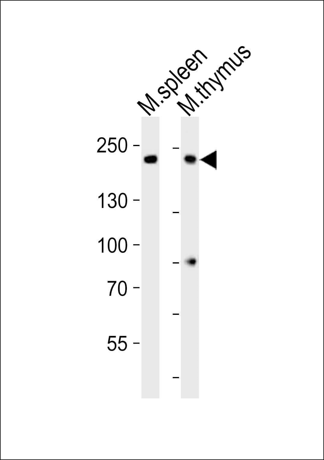 Polyclonal Rabbit anti-Mouse KIAA0191 / ZCCHC11 Antibody (aa1568-1600, WB)