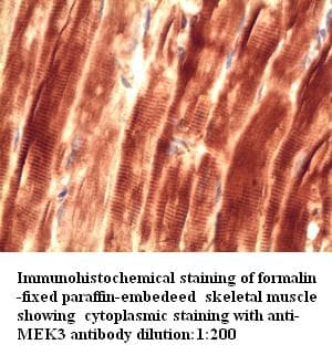 Polyclonal Rabbit anti-Human MAP2K3 / MEK3 / MKK3 Antibody (IHC, WB)