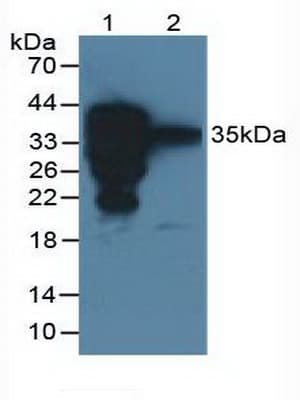 SFTPA2 / Surfactant Protein A2 Antibody (aa21-248)